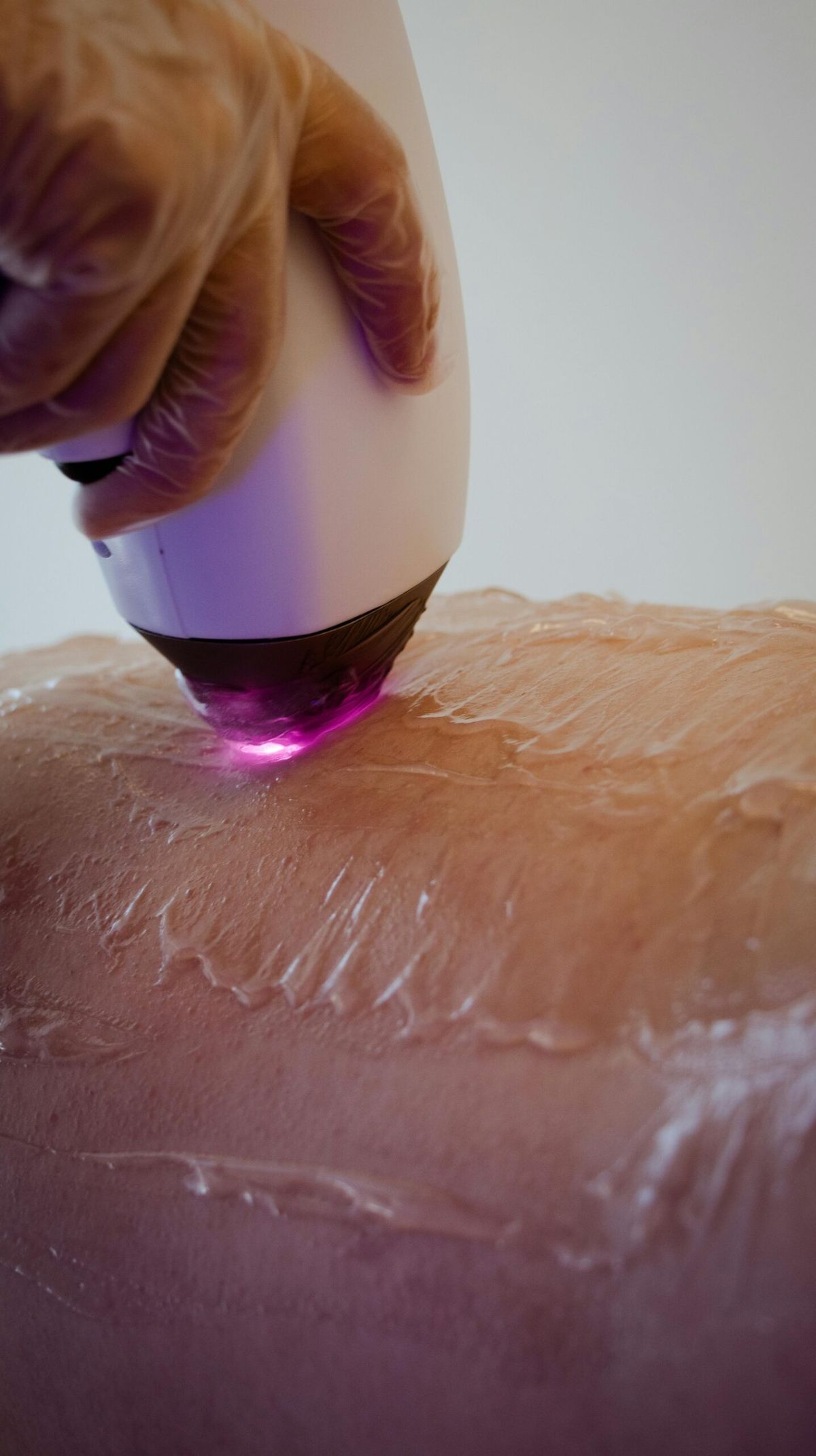 Soprano Ice applicator gliding over cooling gel on skin